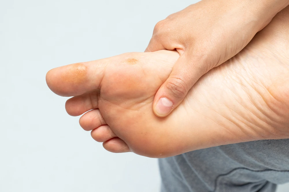 Diyabetik Ayak Yaraları