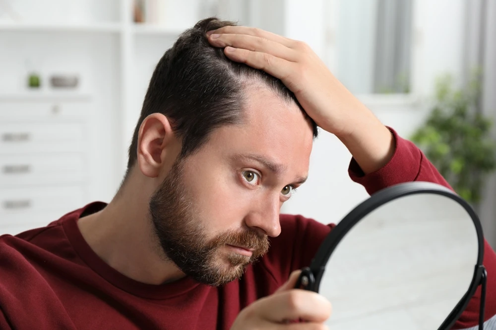 Mezoterapi ile Saç Dökülmesi Nasıl Azaltılır?