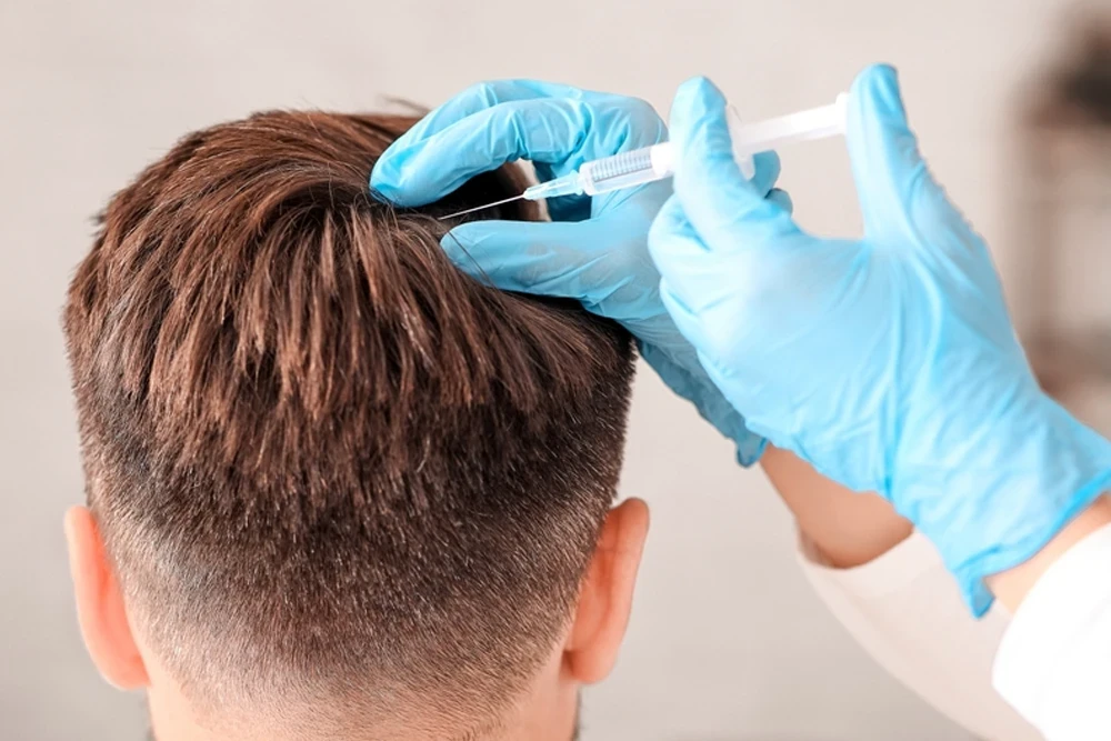 Mezoterapi (Saç & Cilt)